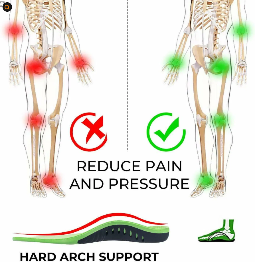 Orthotic Arch Support Insoles for Flat Feet and High Arches